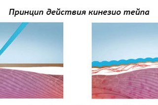 Кинезик
